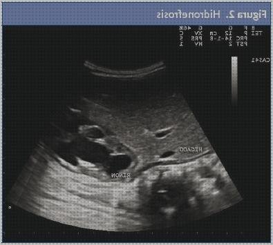 Las mejores tensiometro niños ecografía hepática en niños