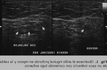 ¿Dónde poder comprar Mas ecografía cabeza grande Mas ecografía coneja ecografías ecografía hernia femoral?