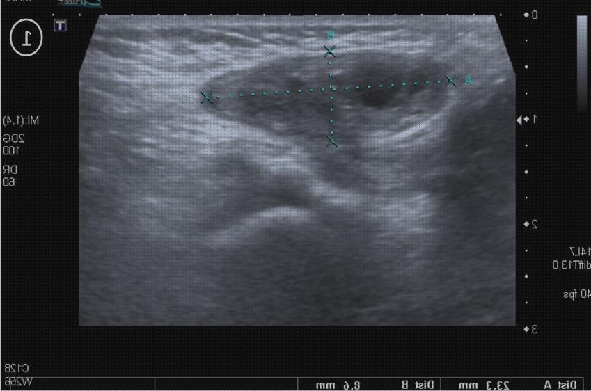 Las mejores Mas ecografía cabeza grande Mas ecografía coneja ecografías ecografía hernia femoral