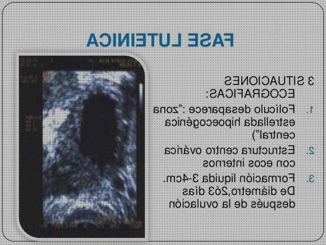 ¿Dónde poder comprar Mas ecografía segundo trimestre embarazo Mas ecografía cabeza grande Mas ecografía coneja ecografía líquido folicular en pelvis?