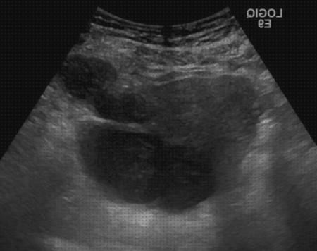 Las mejores Mas ecografía segundo trimestre embarazo Mas ecografía cabeza grande Mas ecografía coneja ecografía líquido folicular en pelvis