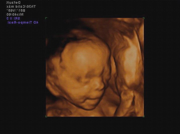 Las mejores semanas ecografía más de 24 semanas embarazo seguridad social