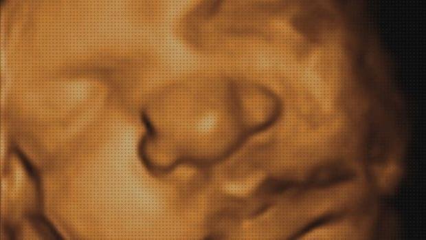 Review de ecografía más de 24 semanas embarazo seguridad social