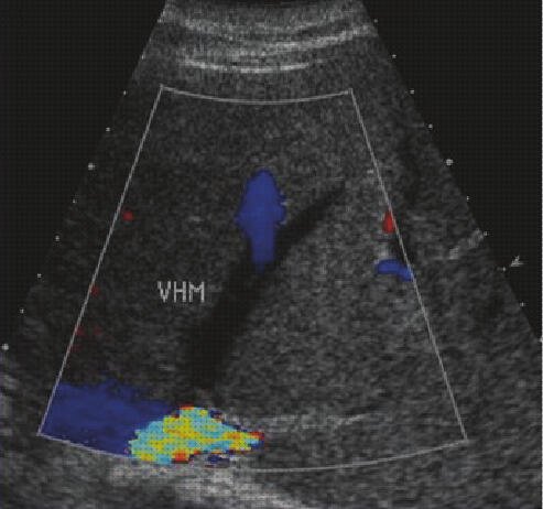 ¿Dónde poder comprar ecografías ecografía media?