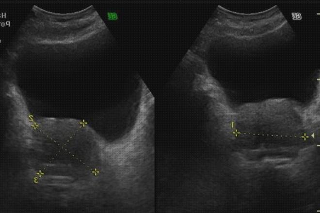 Las mejores ecografías ecografía media