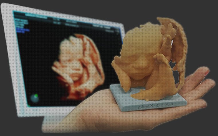 Las mejores Mas ecografía coneja ecografías ecografía muñeco 3d