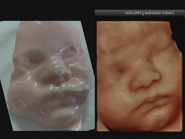 Review de ecografía muñeco 3d