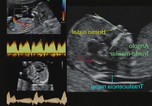 ¿Dónde poder comprar trimestres ecografía obstétrica por trimestres?