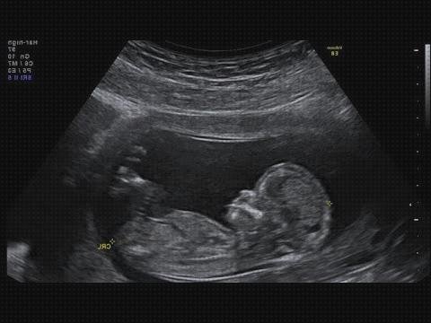 Opiniones de trimestres ecografía obstétrica por trimestres