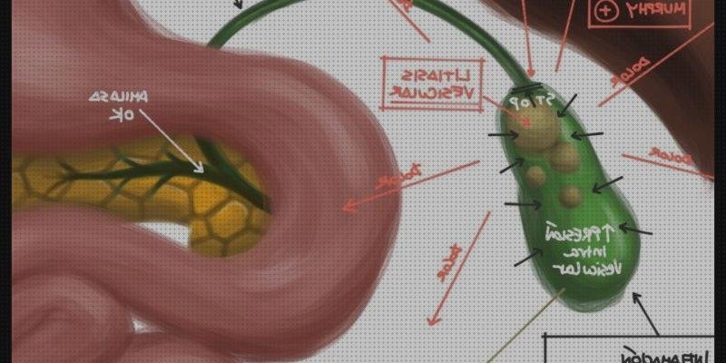 Las mejores osler ecografía osler chuleta
