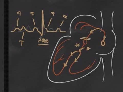 Review de ecografía osler chuleta