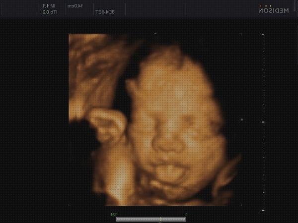 Las mejores ecografía por el dinero