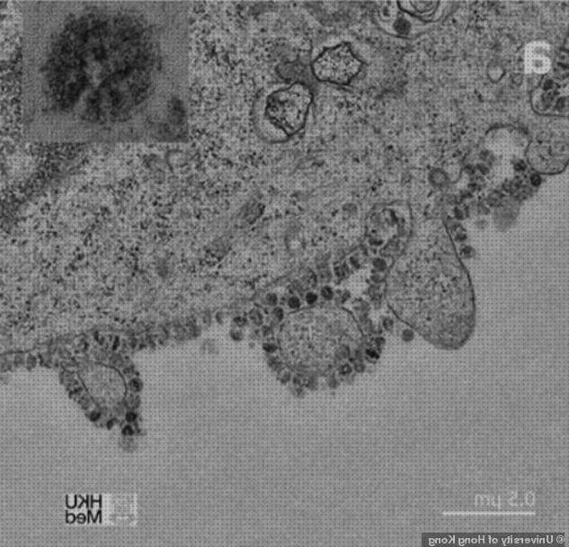¿Dónde poder comprar crucigrama ecografía por ultrasonido crucigrama?