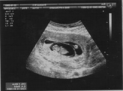 Las mejores crucigrama ecografía por ultrasonido crucigrama