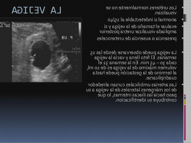 Las mejores prenatal ecografía prenatal vejiga