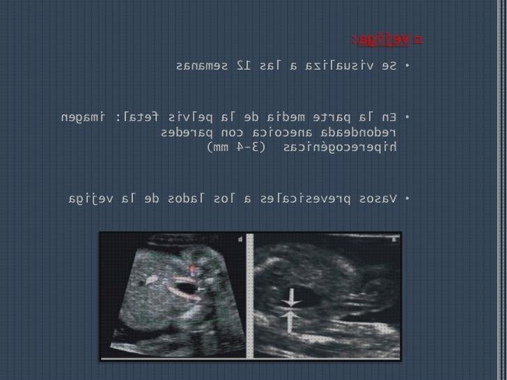 Opiniones de las 8 mejores Ecografías Prenatal Vejigas
