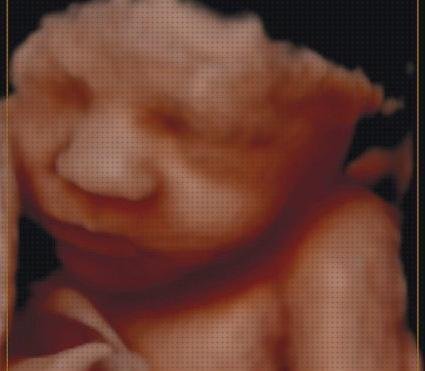 Las mejores Mas ecografía cabeza grande Mas ecografía coneja ecografías ecografía quinta dimensión