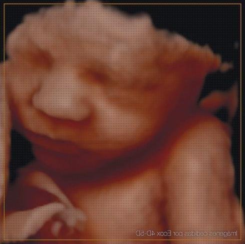 Opiniones de las 6 mejores Ecografías Quintas Dimensiones