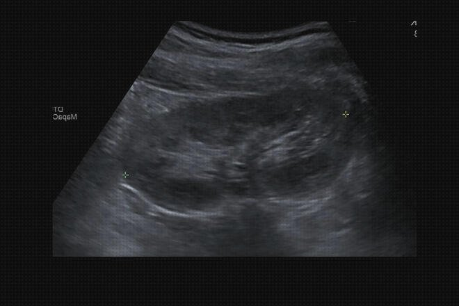 Las mejores Mas ecografía cabeza grande Mas ecografía coneja ecografías ecografía renal completa