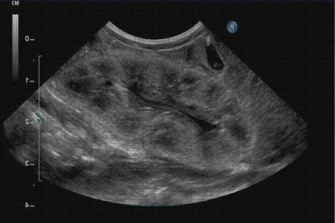 ¿Dónde poder comprar duplex ecografía renal duplex color?