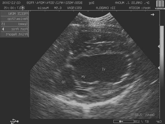 Las mejores 13 Ecografías Renales Modos M