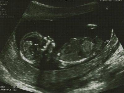 Las mejores marcas de ecografía seguridad social Mas ecografía coneja ecografías ecografía seguridad social demora