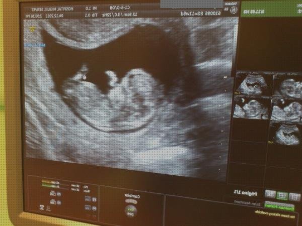 Las 9 Mejores Ecografías Seguridades Sociales Demoras