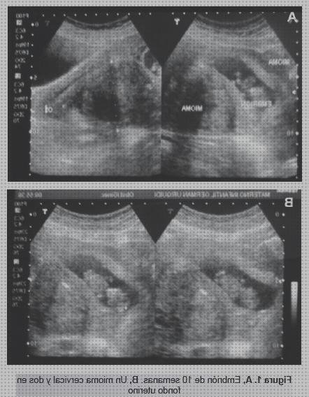 Opiniones de ecografía seriada maternitat