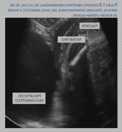 Opiniones de las 7 mejores Ecografías Seriada Maternitat