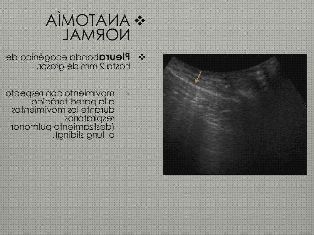 ¿Dónde poder comprar toracica ecografía toracica ptt?