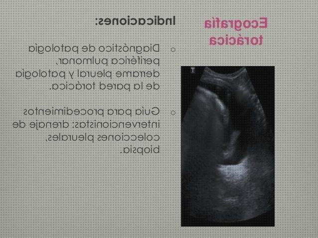 Las mejores 5 Ecografías Toracica Ptt