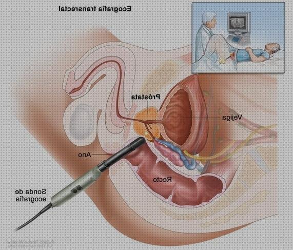 Análisis de las 8 mejores Ecografías Transrectal Cancer Rectos
