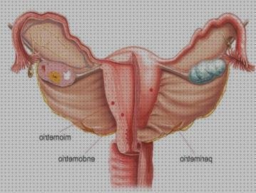 Las mejores utero ecografica ecografia utero anatomia ecografica carcinoma cervical