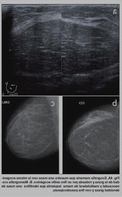 ¿Dónde poder comprar Mas ecografía segundo trimestre embarazo Mas ecografía cabeza grande Mas ecografía coneja ecografía y bag de pecho?
