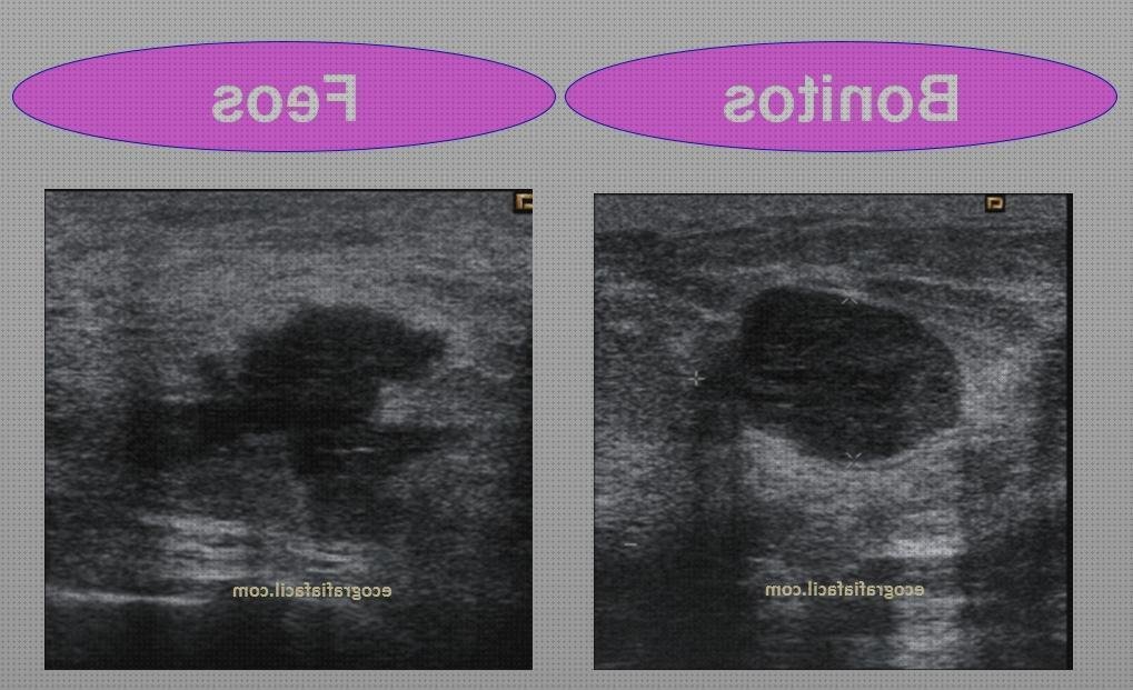 Review de ecografía y bag de pecho