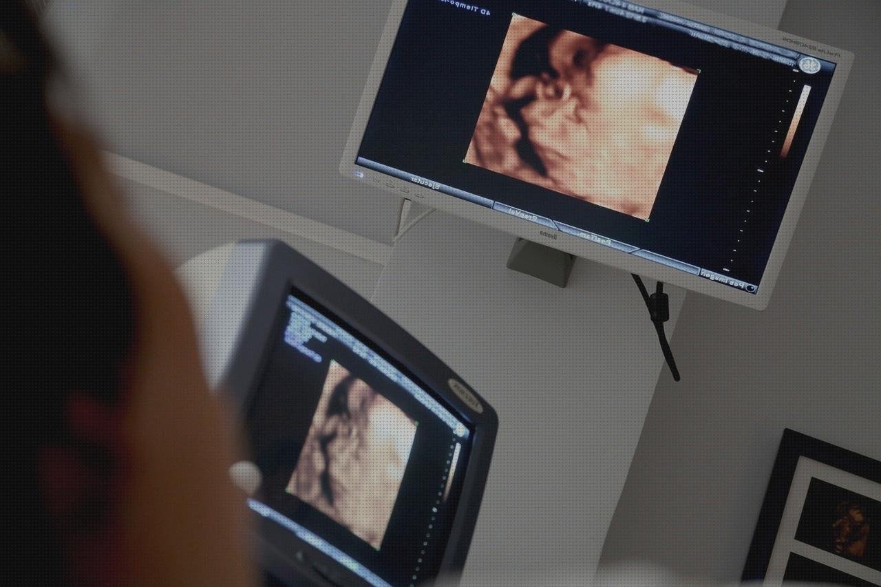 Las mejores Mas ecografía cabeza grande Mas ecografía coneja ecografías ecografía y ecocardiografía