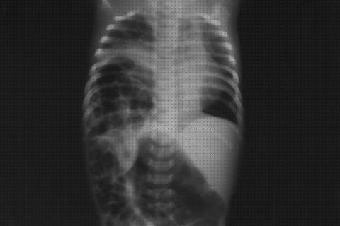 ¿Dónde poder comprar ecografía y hernia hiatal?