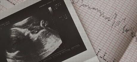 Las mejores marcas de ecografías bebe ecografías ecografías bebe latido corazon