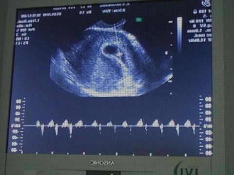 Las mejores ecografías bebe ecografías ecografías bebe latido corazon