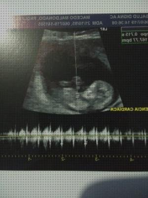 Las 18 Mejores Ecografías Para Bebes Latidos Corazones