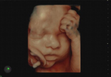 Opiniones de las 13 mejores Ecografías Para Bebes