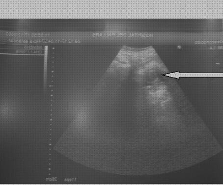 ¿Dónde poder comprar sonda ecografía con sonda vesical?