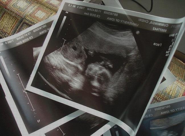 Las mejores meses ecografías cuatro meses
