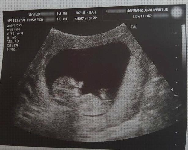 Review de ecografías cuatro meses