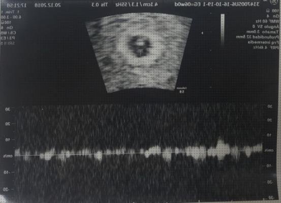 ¿Dónde poder comprar ecografías por semanas Mas ecografía coneja ecografías ecografías de embarazo de 6 semanas?