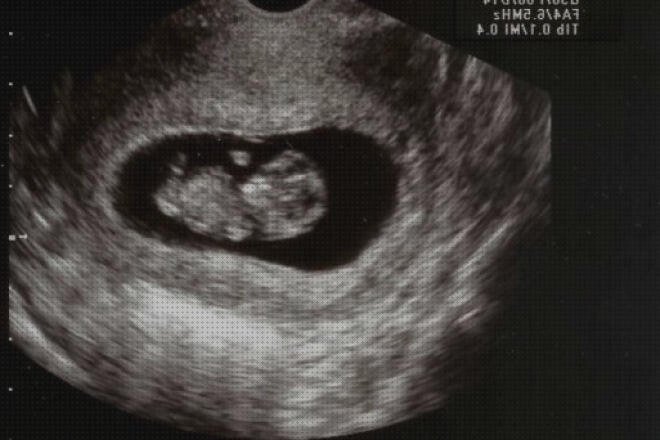 Las mejores marcas de ecografías por semanas Mas ecografía coneja ecografías ecografías de embarazo de 6 semanas