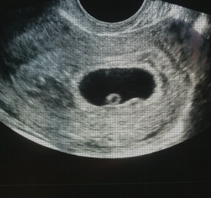 Las mejores ecografías por semanas Mas ecografía coneja ecografías ecografías de embarazo de 6 semanas