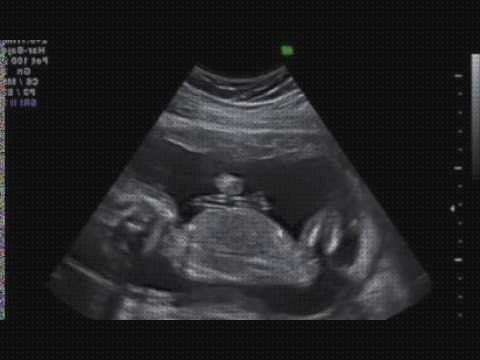 ¿Dónde poder comprar meses ecografías de niña 4 meses?