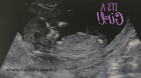 ¿Dónde poder comprar ecografías por semanas Mas ecografía coneja ecografías ecografías de niña de 12 semanas de perfil?