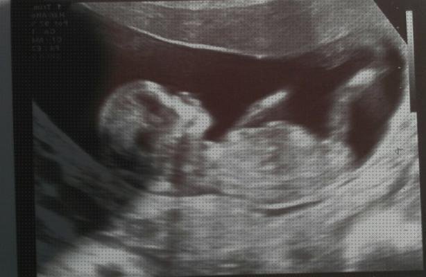 Opiniones de ecografías por semanas Mas ecografía coneja ecografías ecografías de niña de 12 semanas de perfil